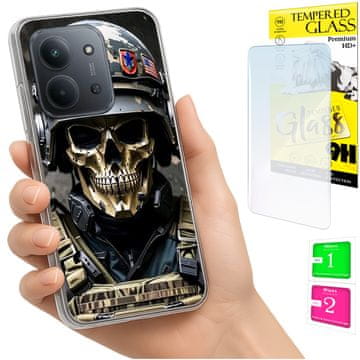 shumee Ovitek za Xiaomi Redmi 15C 4G 171 mm ohišje FOTO ovitek zadnja stran 9H STEKLO