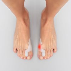 InnovaGoods Silikonski zaščitni korektor bunion Bunilief InnovaGoods Pakiranje 2 enot