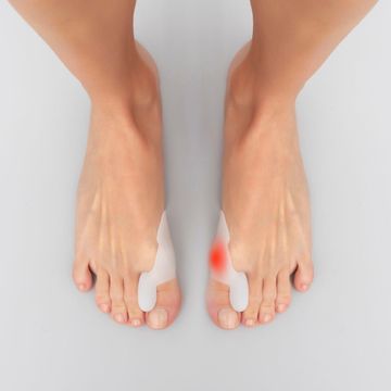 InnovaGoods Silikonski zaščitni korektor bunion Bunilief InnovaGoods Pakiranje 2 enot