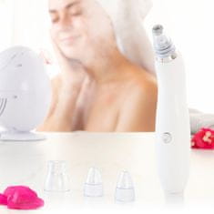 InnovaGoods Električno čistilo za obraz z ogrci Pore·Off InnovaGoods