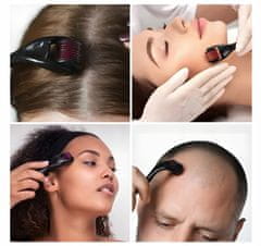 shumee Derma Roller valjček za mezoterapijo 540 igel za obraz in telo 0,5 mm