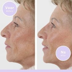 1kosmetika Polnilo za gube - Serum proti gubam - 15 ml - 3 pak