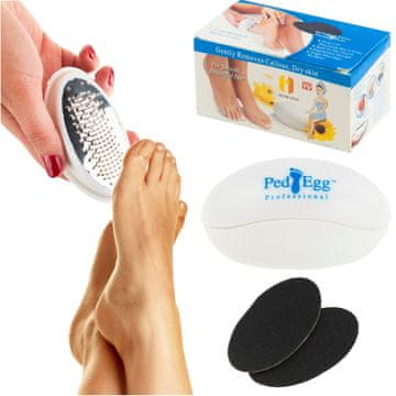 TOP GIFT TG66303 pedegg pila za stopala in pete s plovcem za pedikuro
