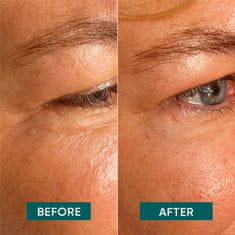 Apricot Apricot Smoothing Eye and Temples Patches "aloe there"