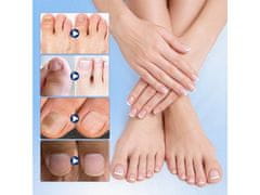Cool Mango obliži za nego nohtov pri glivičnih spremembah, zračni in diskretni, 21 kosov - NailFix