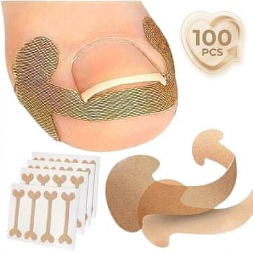 Cool Mango korektor za nohte za udobnejšo nego iz zračne netkane tkanine, 100 kosov - NailCorrect