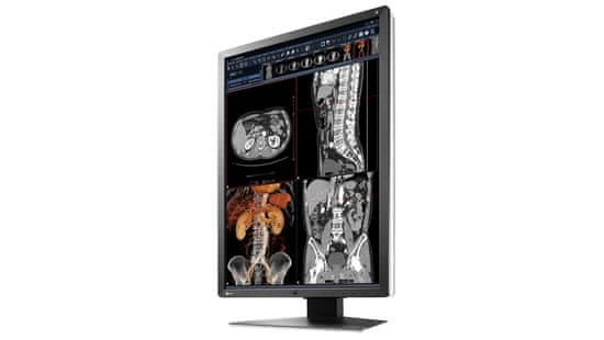 Eizo LED IPS medicinski monitor RadiForce RX250 | mimovrste=)