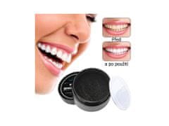 Alum online Čudežni zobje - oglje za beljenje zob