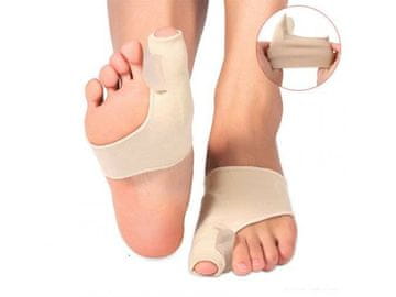 Zaparevrov Fiksator za primerjavo bunijev, 1 par