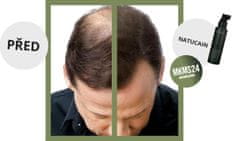 Natucain Tonik za lase v obliki tonika za podporo rasti las ( Natura l Hair Activator) 100 ml