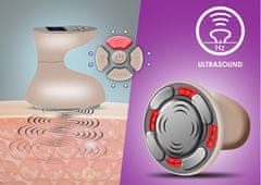 BeautyRelax Celluform Optimalna masažna naprava za oblikovanje telesa