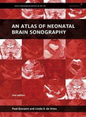 Atlas of Neonatal Brain Sonography - Clinics in Developmental Medicine