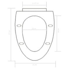 Vidaxl WC deska s počasnim zapiranjem hitra namestitev bela