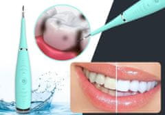 Alum online Električni čistilec zob