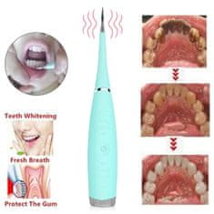 Alum online Električni čistilec zob
