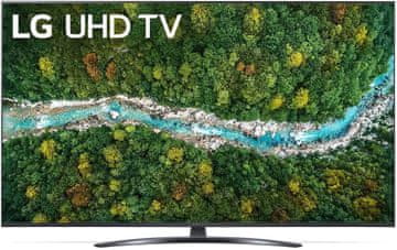 LG 43UP78003LB 43 4K UHD televizor
