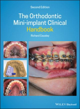 Orthodontic Mini-implant Clinical Handbook 2nd Edition