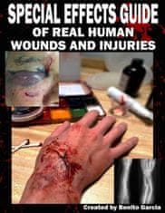 Special Effects Guide Of Real Human Wounds and Injuries: Special Effects Guide Of Real Human Wounds and Injuries