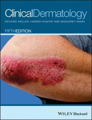Clinical Dermatology 5e
